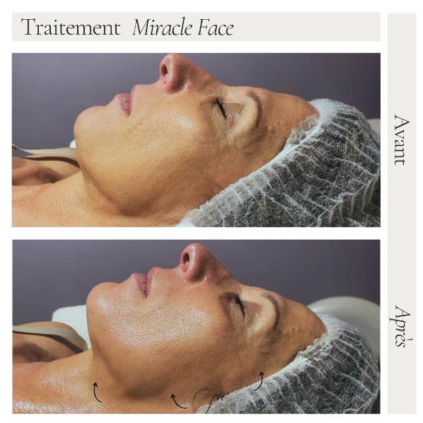 miracle-face